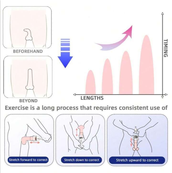 Adjustable Hanging Traction Stretcher System